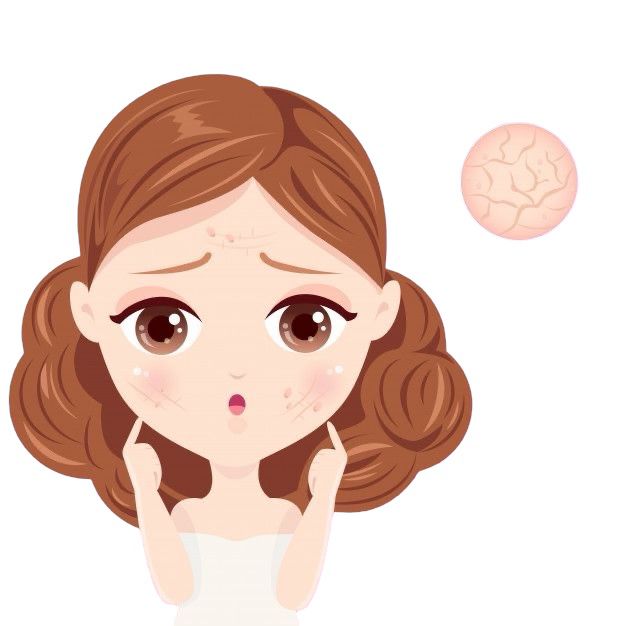 Dry Skin